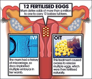 Infografia de The Sun